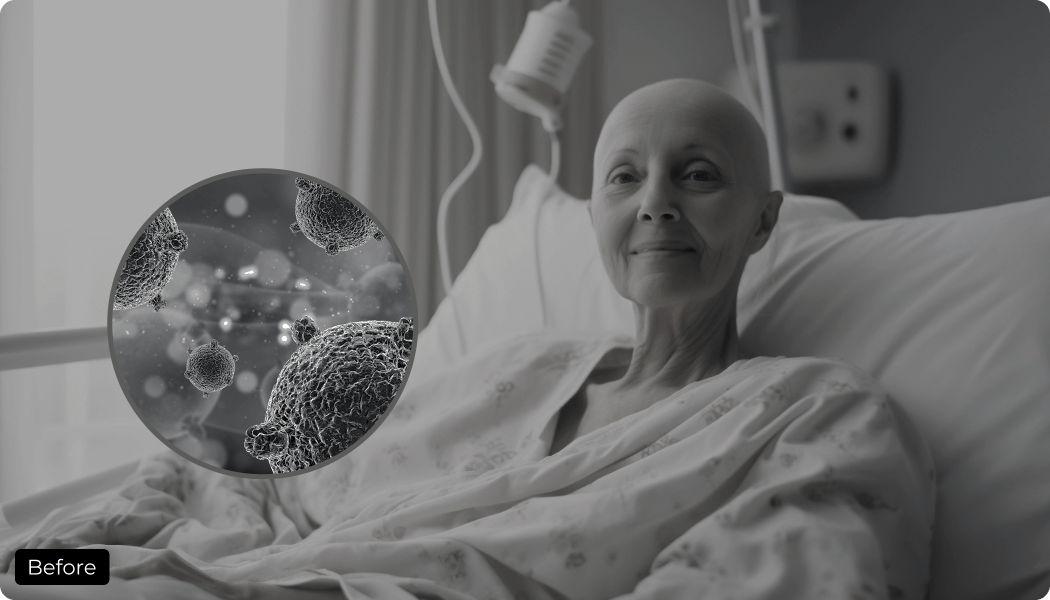 Cancer Before